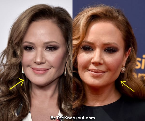 Leah Remini Plastic Surgery Comparison Photos