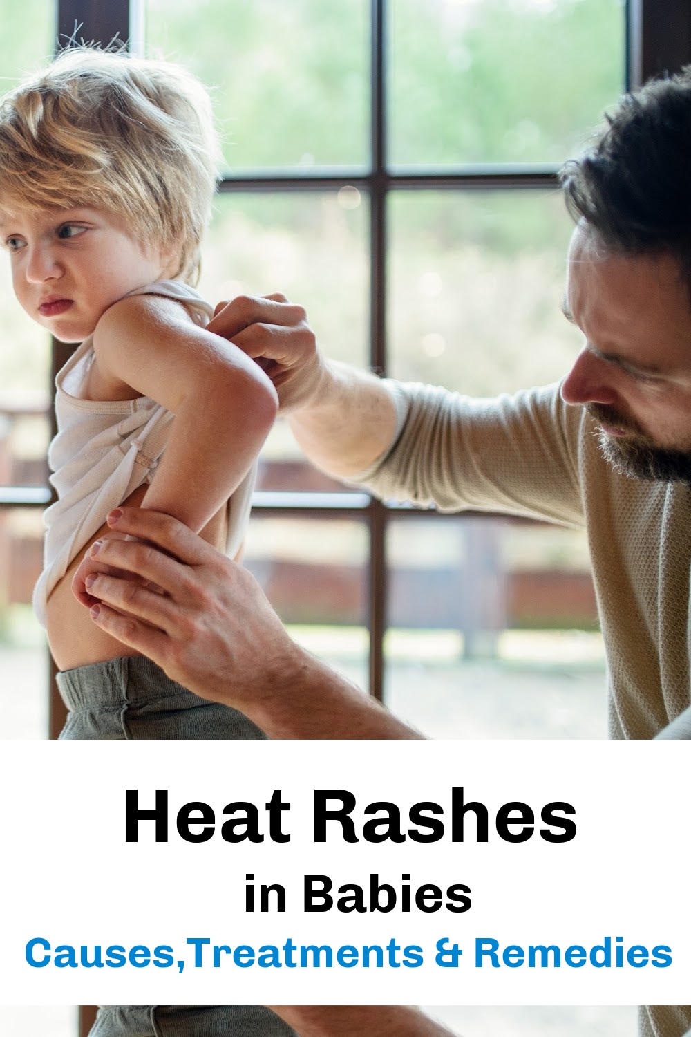Heat Rashes in Babies Causes, Treatments, and Remedies