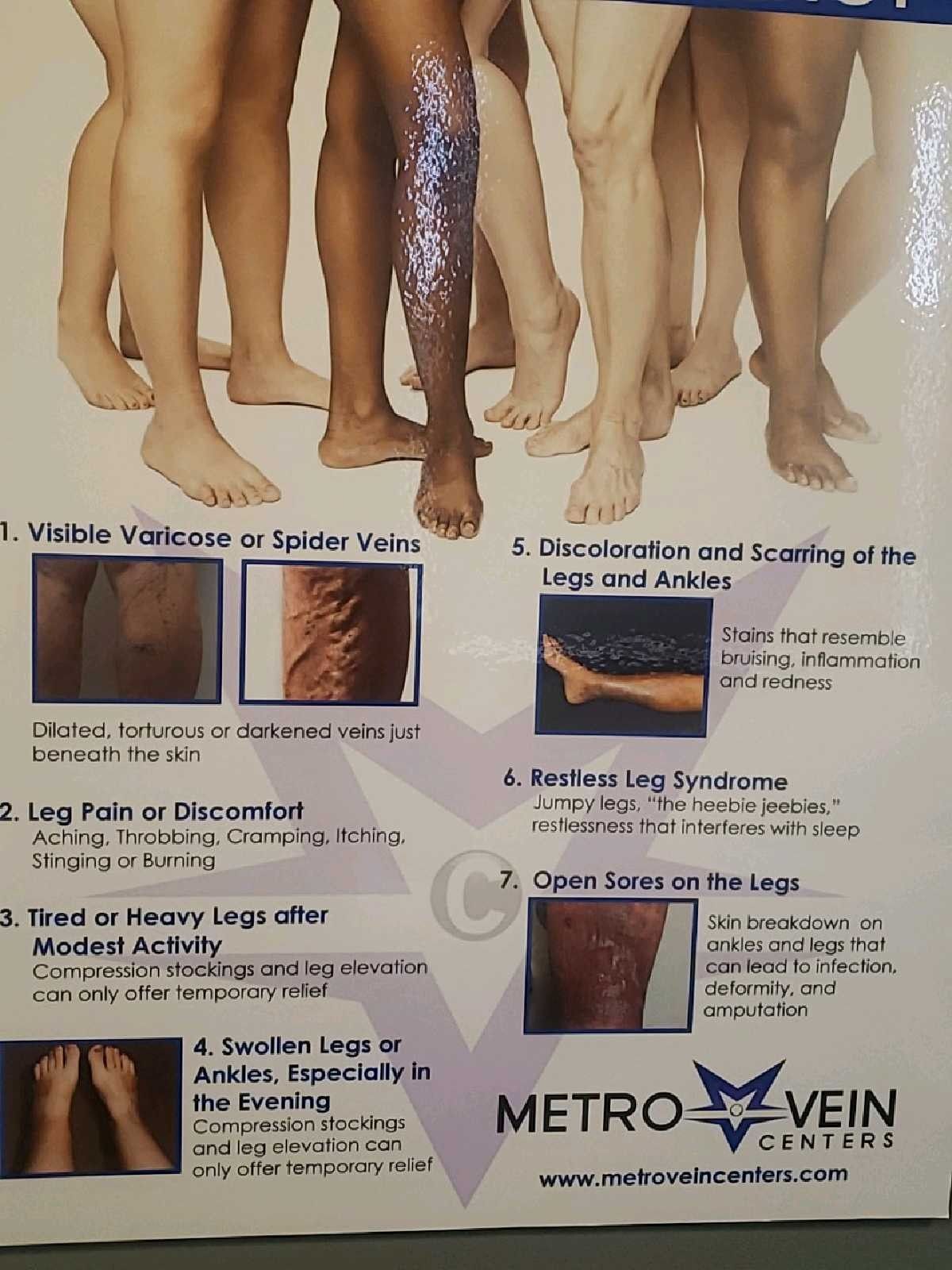 The Relationship Between Restless Leg Syndrome And Knee Pain Brandon Orthopedics