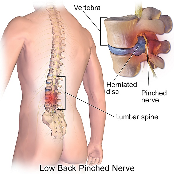 The Spine And Spinal Stenosis Brandon Orthopedics