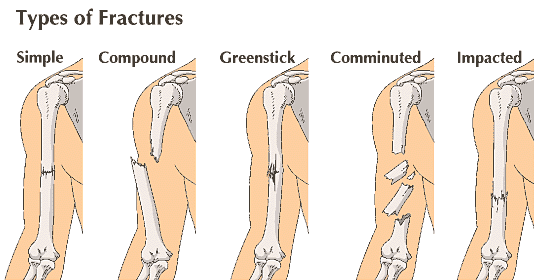 fracture Students Britannica Kids Homework Help