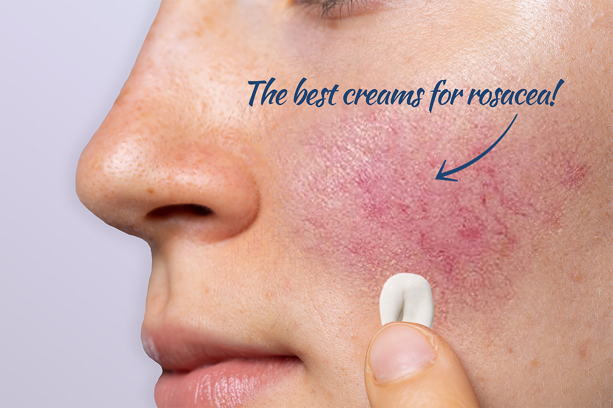Best Rosacea Creams and Serums