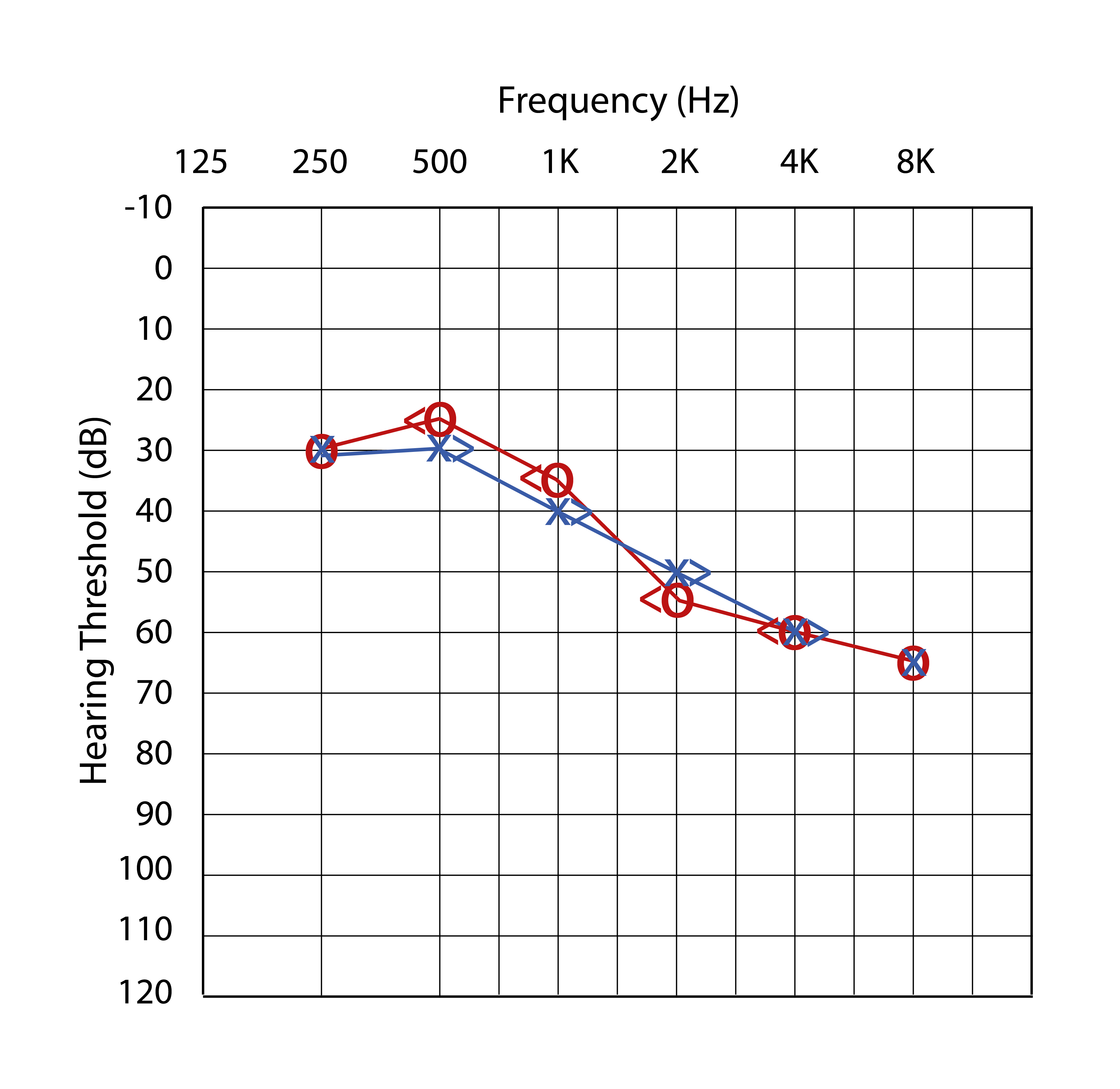 What Is an Audiogram? And How Do You Read It?