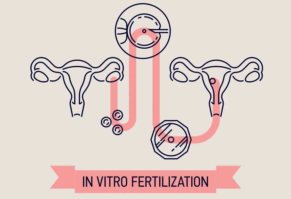 Assisted Reproductive Technology (ART) Infertility Treatment