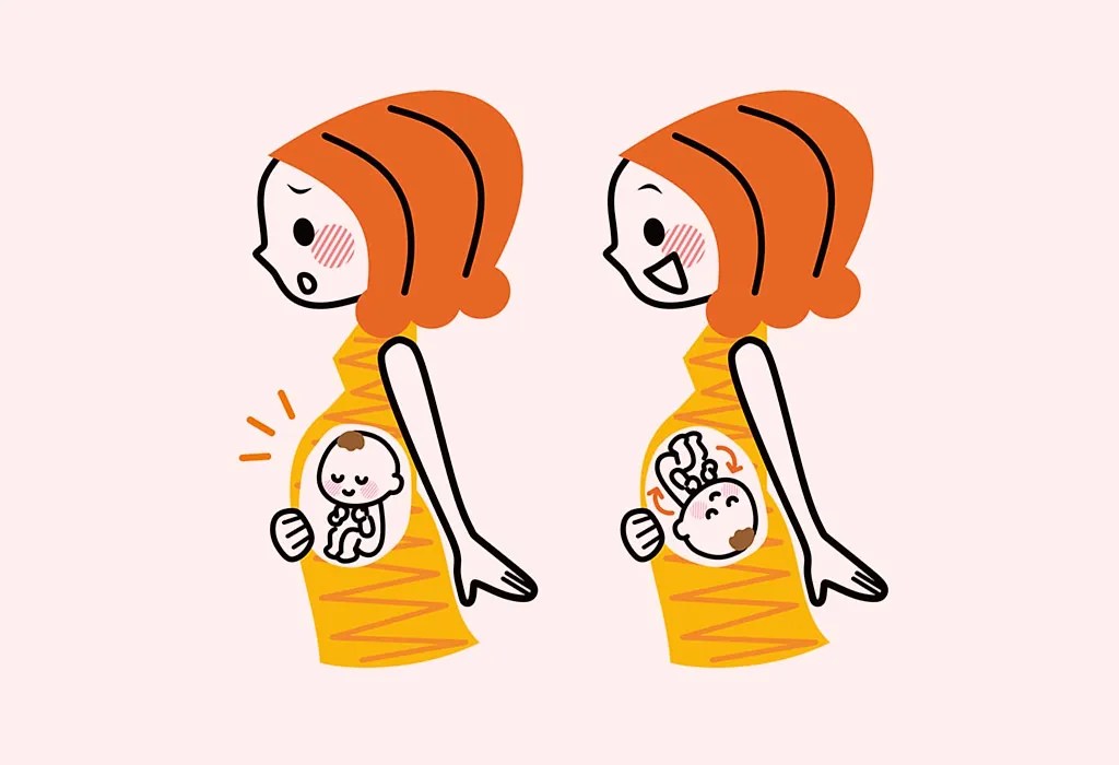 Umbilical Cord Prolapse Causes,Treatment and Prevention