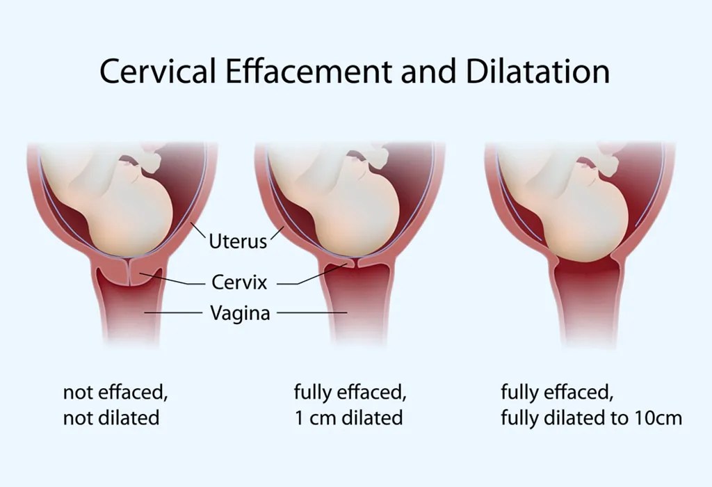 Natural Delivery Stages, Benefits & Preparation Tips