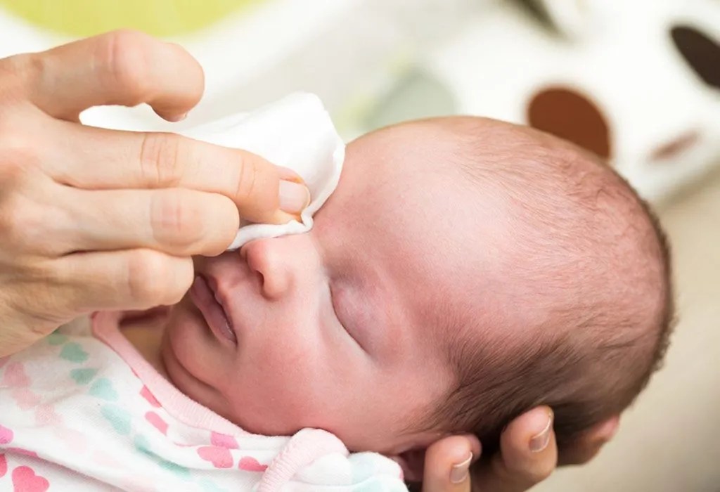 Newborn Sticky Eye Causes, Signs, Treatment & Prevention