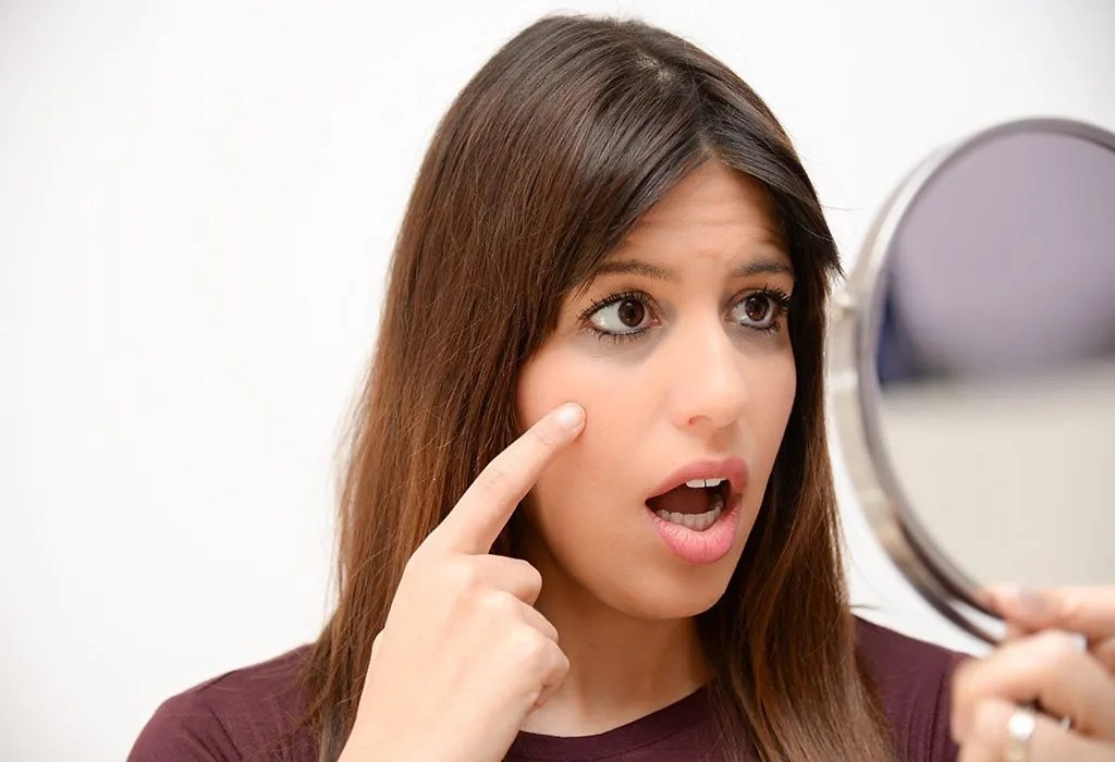 Dark Circles in Pregnancy Causes & Natural Treatment