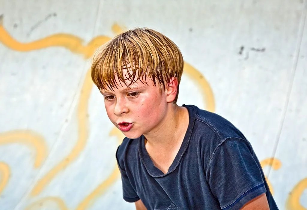 Excessive Sweating (Hyperhidrosis) In Children Causes, Signs & Treatment