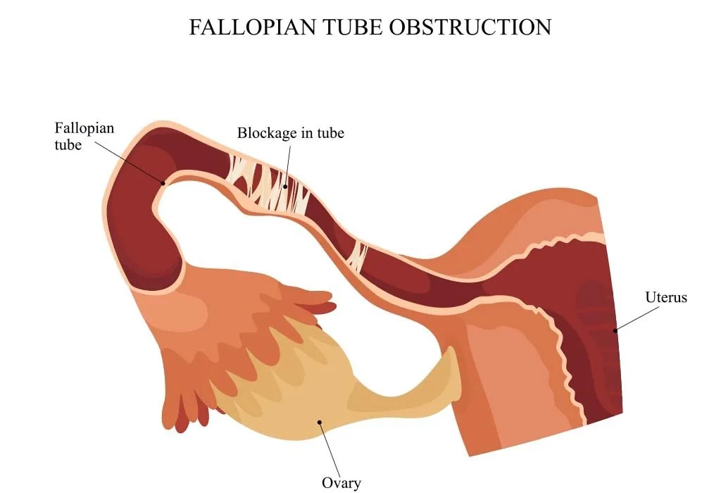 Using Castor Oil for Fertility Health Benefits & Precautions