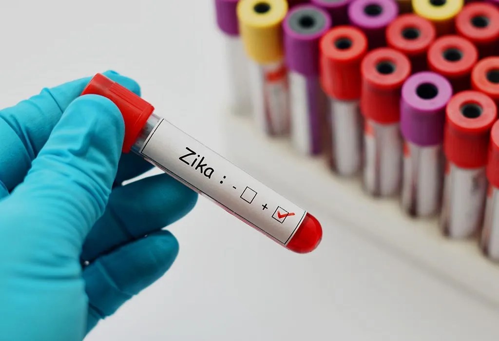 Zika Virus during Pregnancy Symptoms, Diagnosis & Treatment