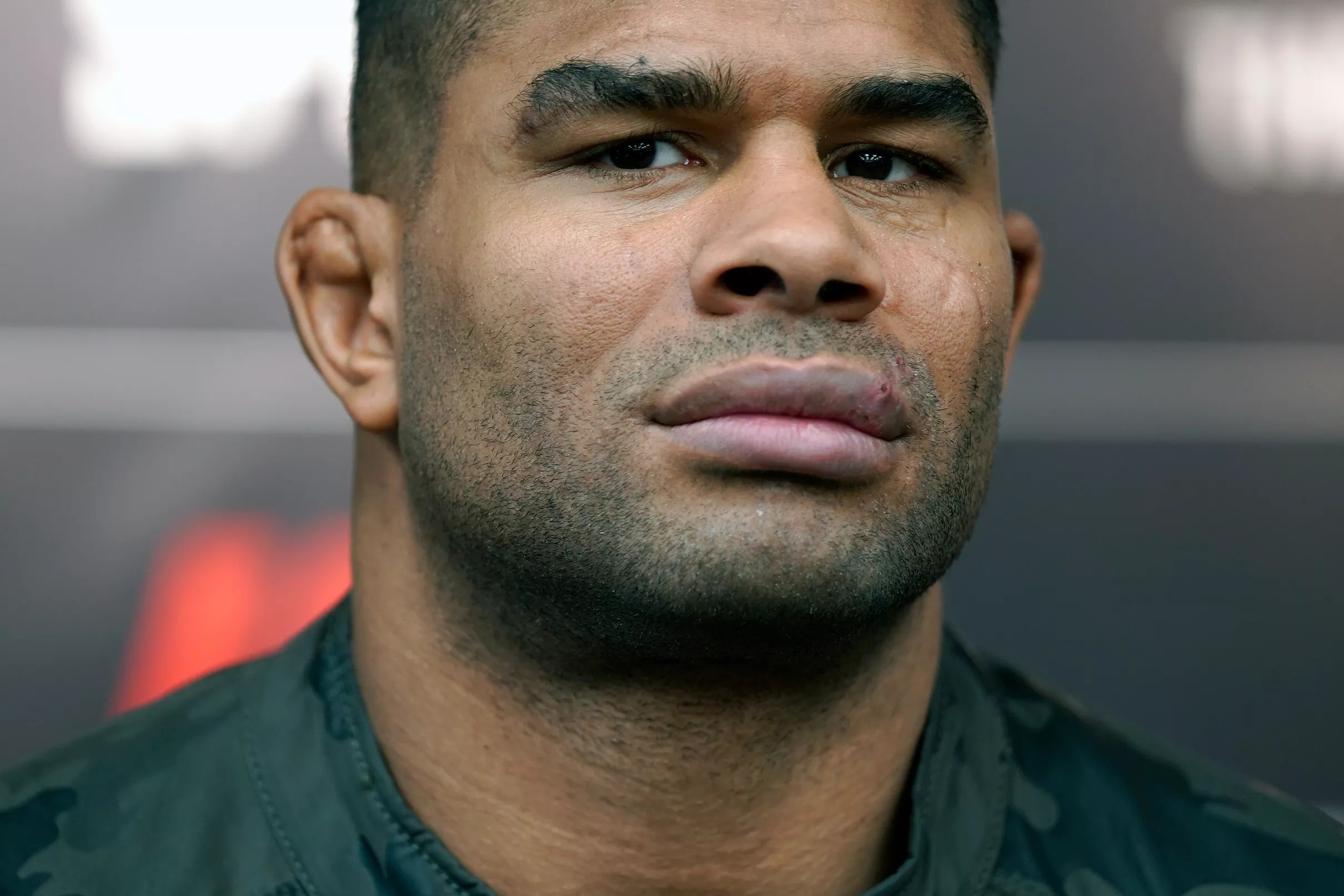 Photo Alistair Overeem’s lip healed up two weeks after KO loss at UFC