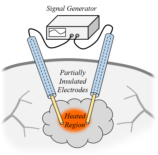 Study Radiofrequency Tissue Ablation Using Simulation COMSOL Blog