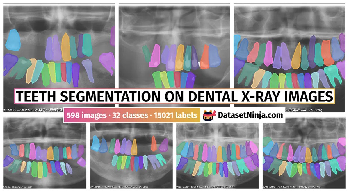 Teeth Segmentation on Dental Xray Images Dataset Ninja