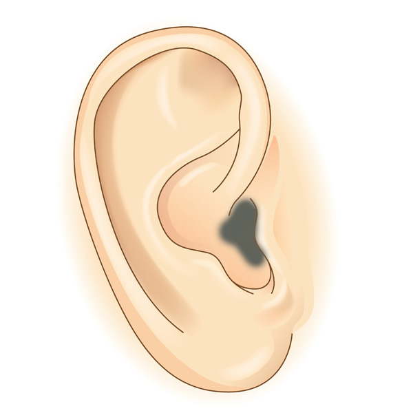 This Is What Your Earwax Reveals About Your Health David