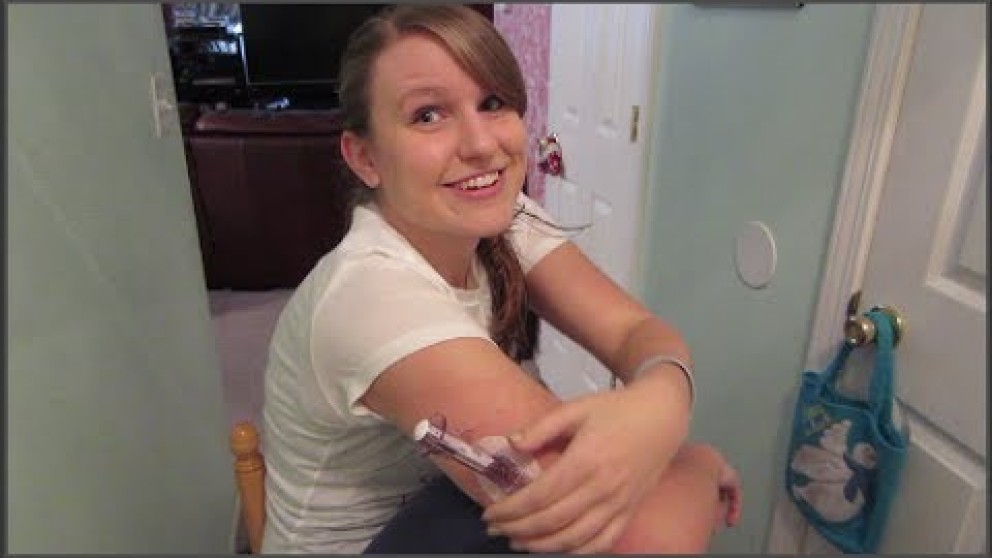 How to Wear a CGM on Your Arm Diabetes Daily
