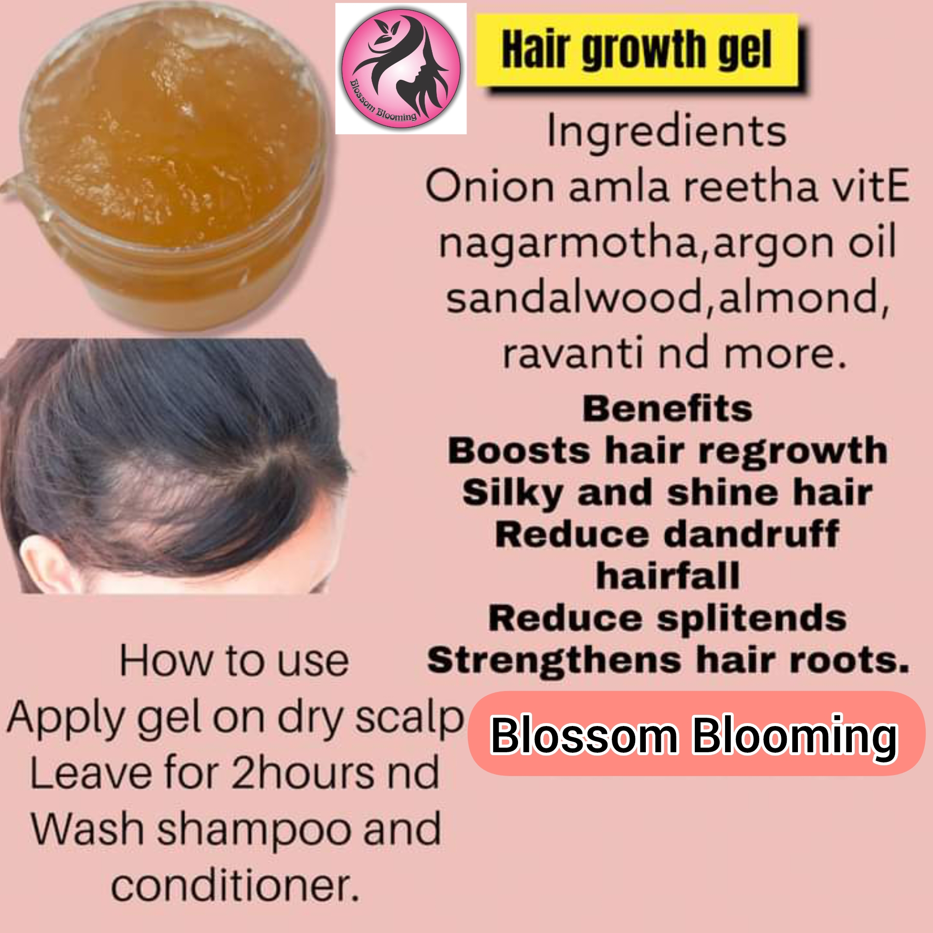 Details more than 79 hair growth gel latest in.eteachers