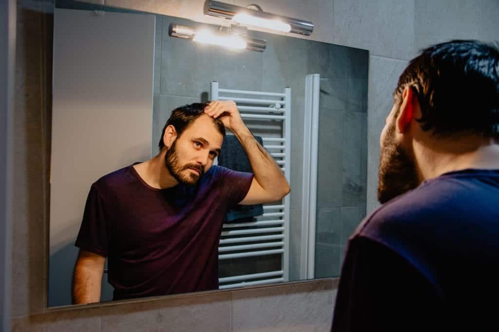 9 Reddit Users on Balding At 20 Shared Experiences 9 Reddit Users on Balding At 20 Shared Experiences