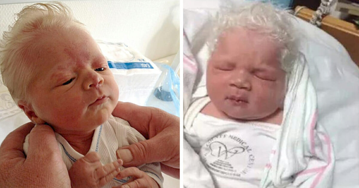 Baby born with full head of gray hair wins the hearts of all around him