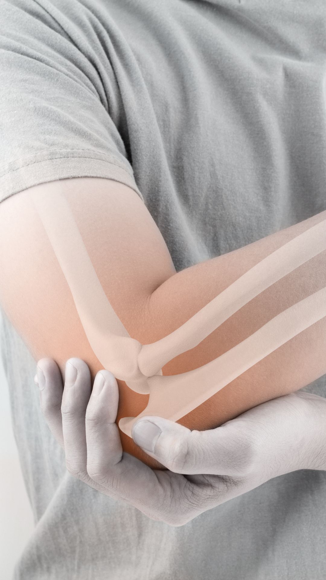 Osteoporosis Day 7 dry fruits that are good for your bones