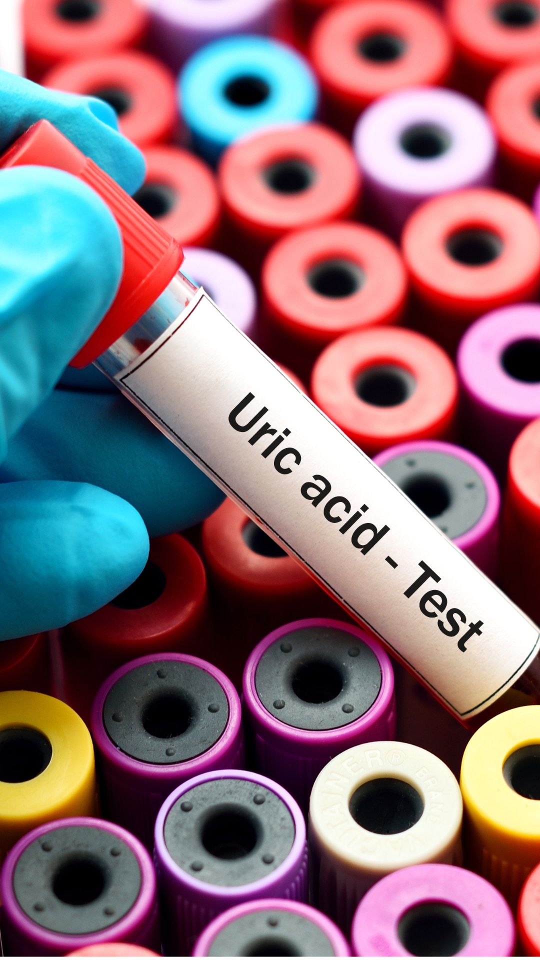 6 Foods to avoid to control Uric Acid level