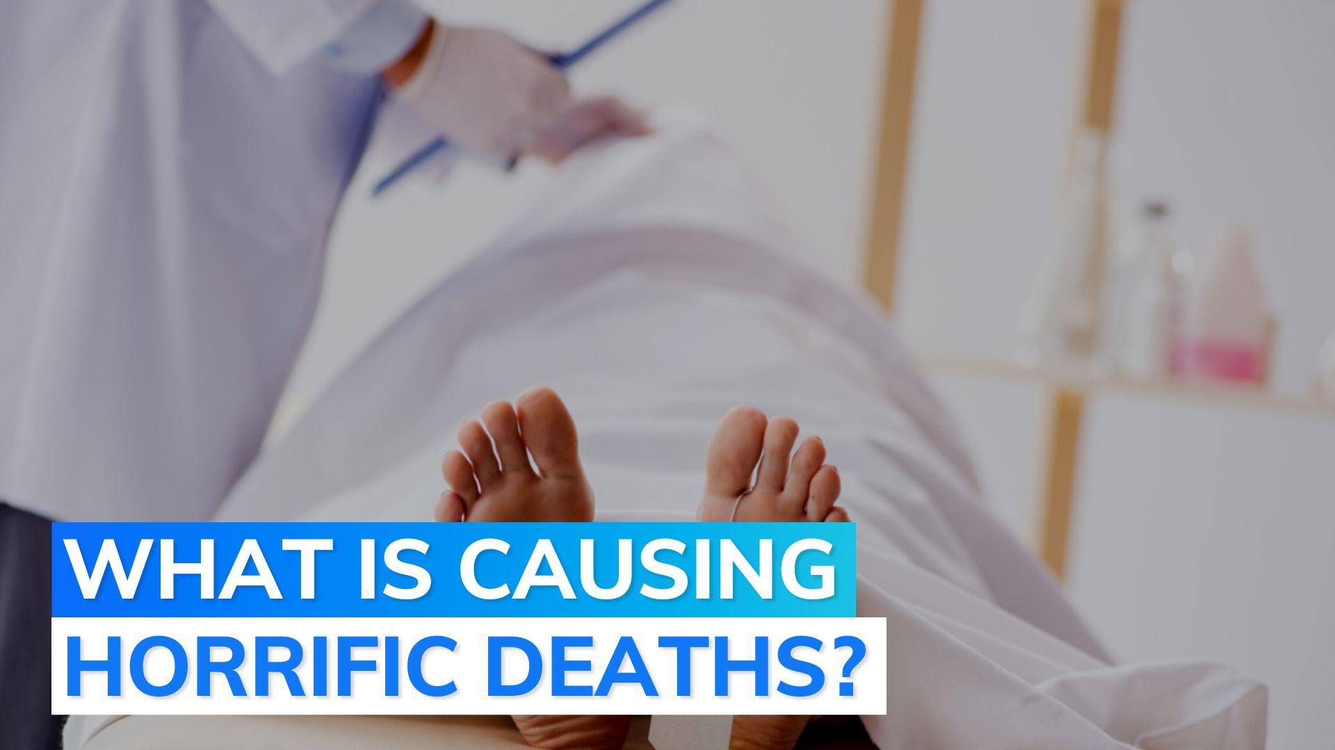 Flesheating bacteria Vibrio vulnificus kills 3 in US Editorji