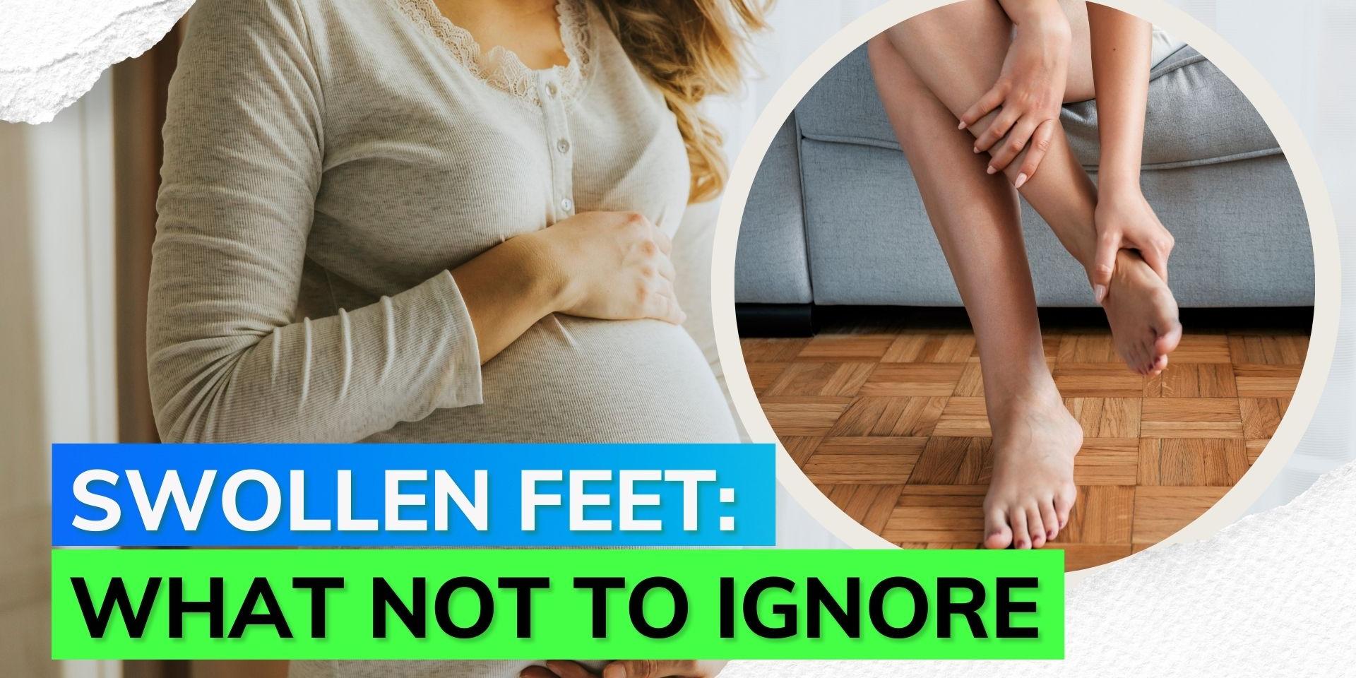 Know why feet get swollen during pregnancy and the signs you should not