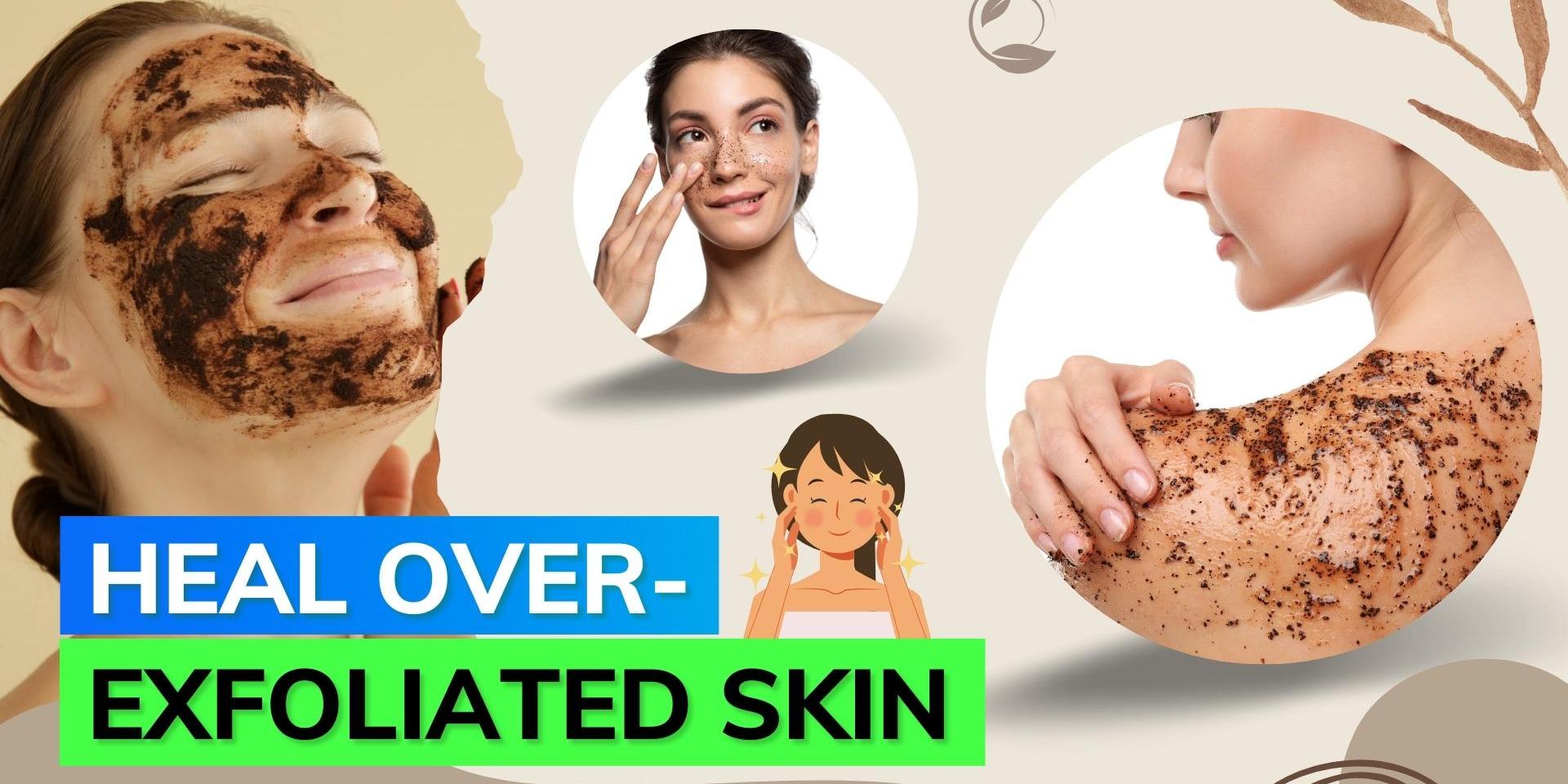 Signs Skin Is Over Exfoliated at Carolyn Halfacre blog