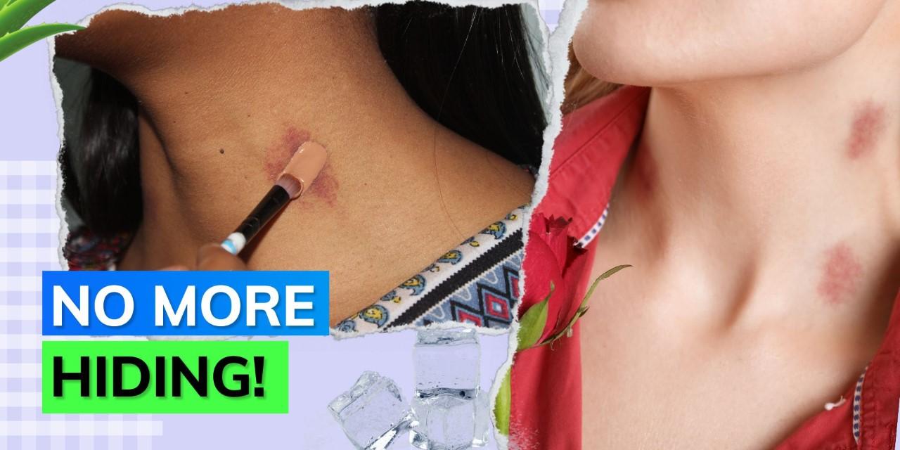How To Hide Hickeys With Makeup Top 3 Fast & Easy Hacks To Remove