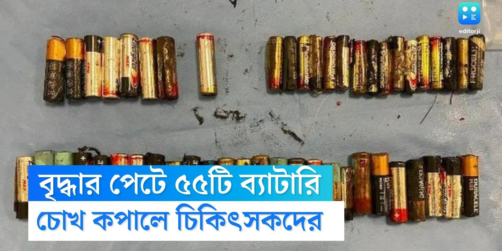 Ireland Doctors remove 55 batteries from 66 year old woman‘s stomach