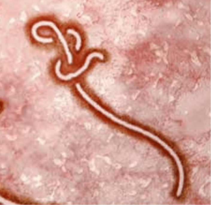 What You Need to Know About Ebola in the Eye