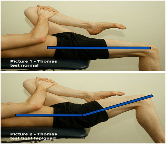 Treating Motor Pattern Dysfunction Are Your Corrective Exercises