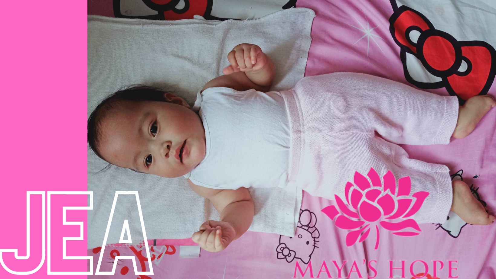 Maya's Hope Child born with club foot, hydrocephalus, and spina bifida