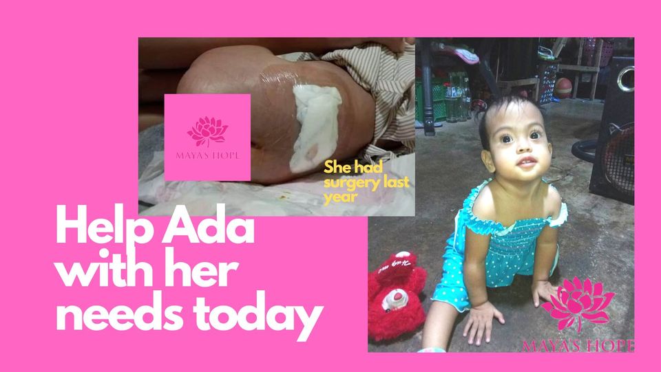 Maya's Hope Baby born with Spina Bifida needs formula, diapers, and