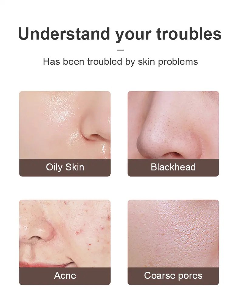 12 Best Blackhead Removal Tools of 2023