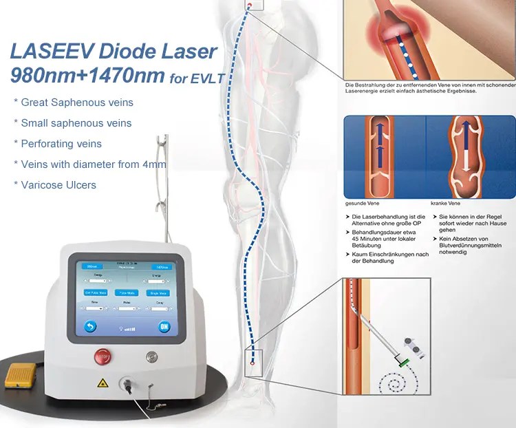 China Advanced Diode Lasers for Varicose Veins Treatment 980nm