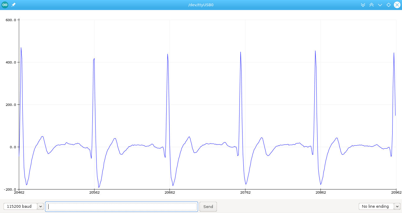ECG Filter Arduino code Details Hackaday.io