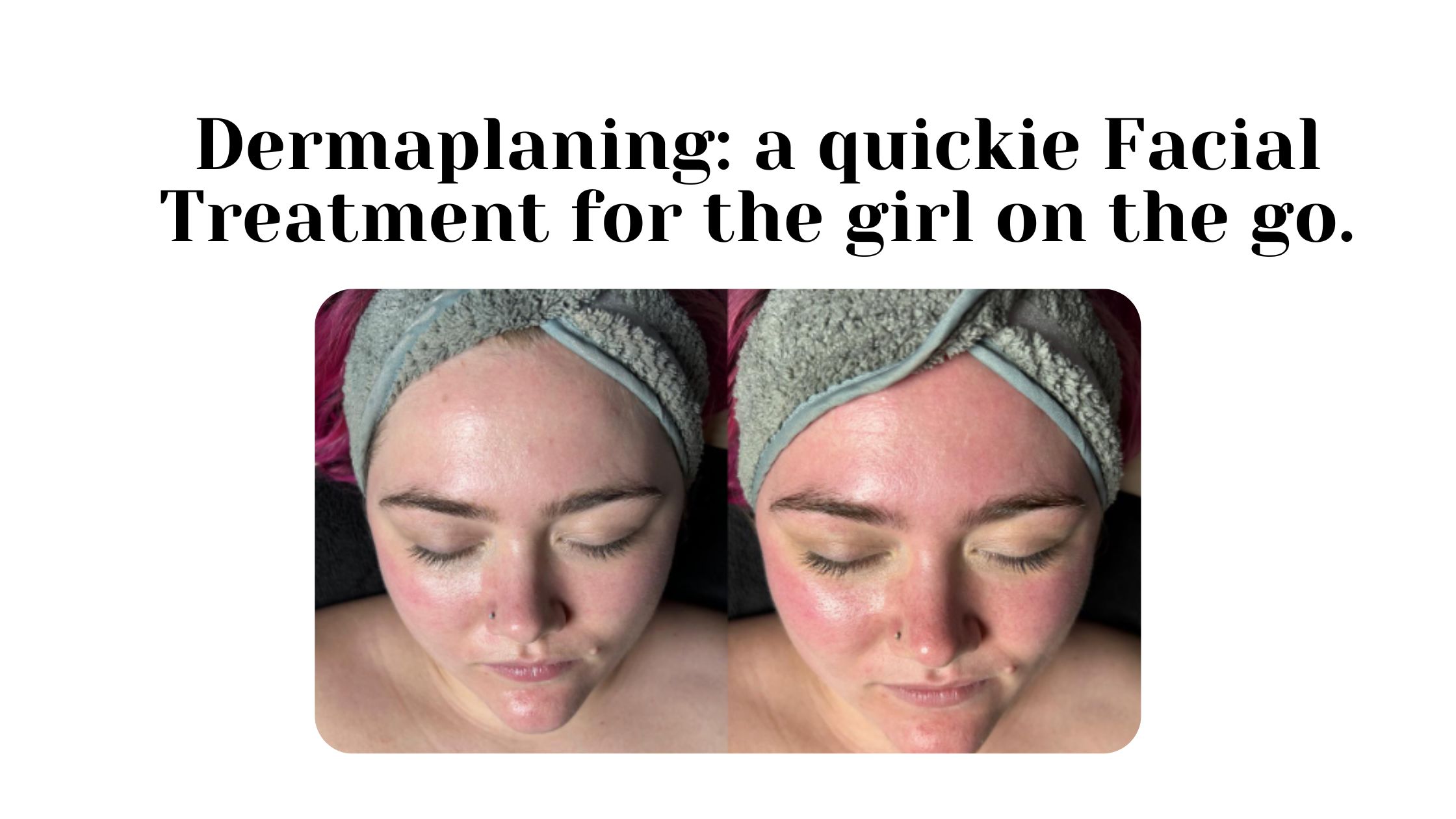 Dermaplaning a quickie Facial Treatment