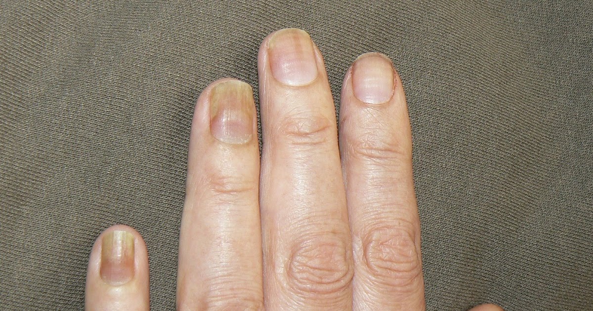 Getting A Pedicure After Chemo What You Need To Know Heidi Salon