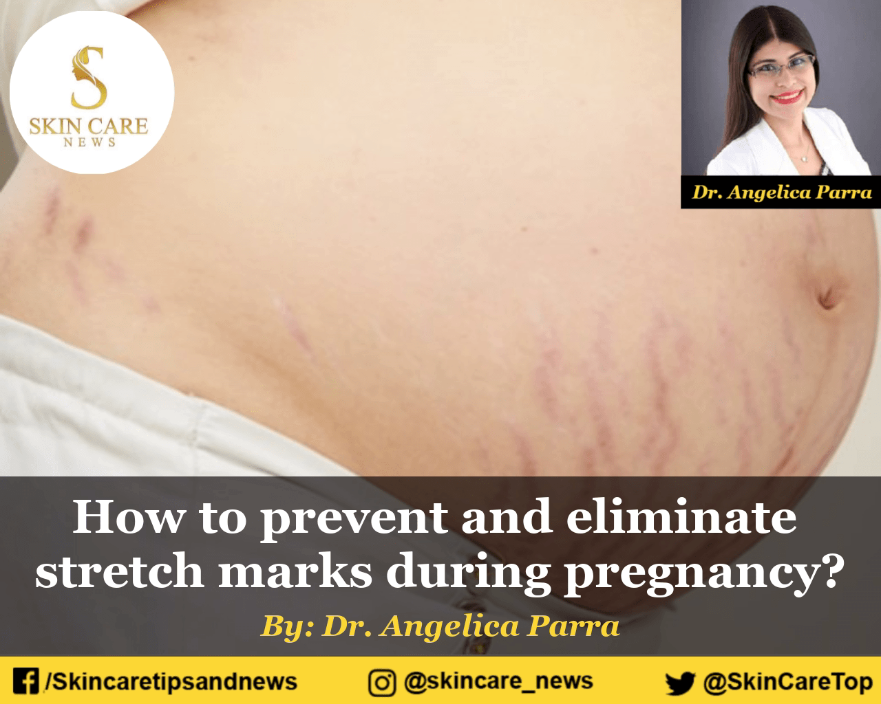 Why Pregnancy Causes Oily Skin And How To Manage It Heidi Salon