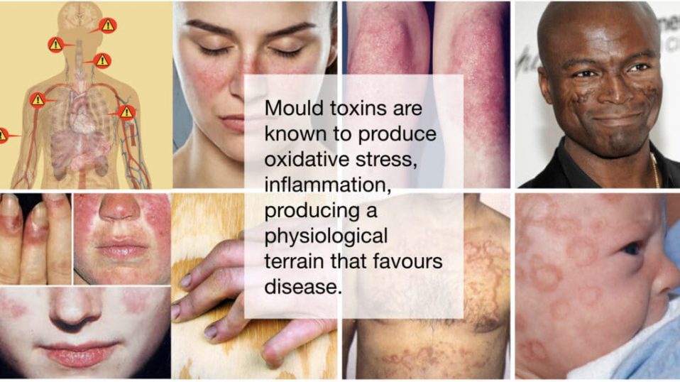 The Dangers Of Powdery Mildew Heidi Salon