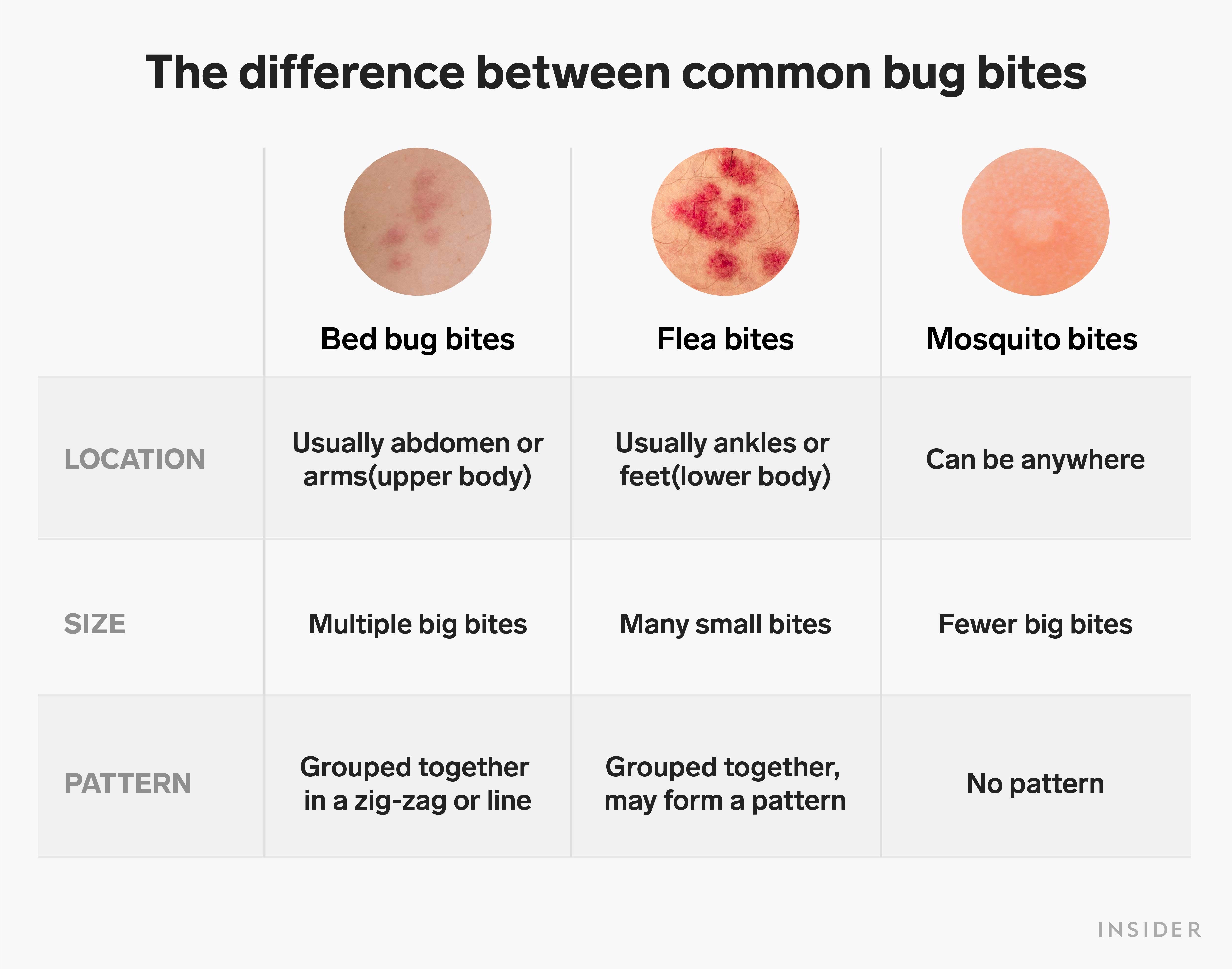 Bed Bug Bites Causes Symptoms And Treatment Heidi Salon
