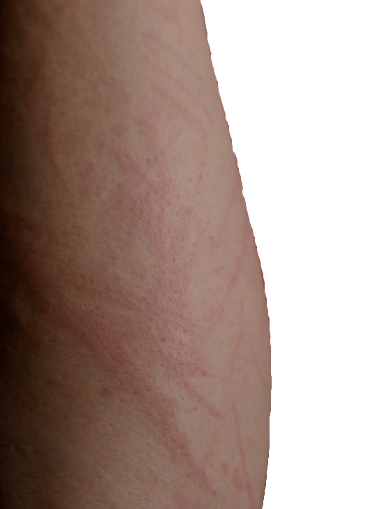 How To Soothe And Protect Your Irritated Skin Heidi Salon