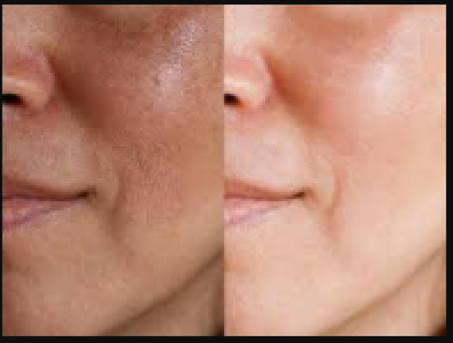 How To Get Rid Of Dead Skin On Your Head Heidi Salon