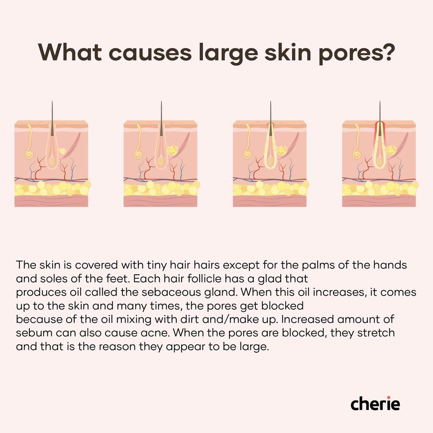 3 Ways To Minimize The Appearance Of Enlarged Pores If You Have Oily
