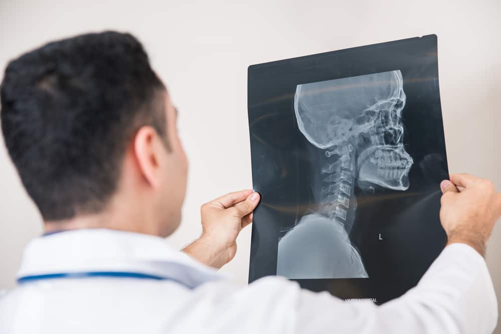 Symptoms of Brain Injury After Hitting Head And Other Signs