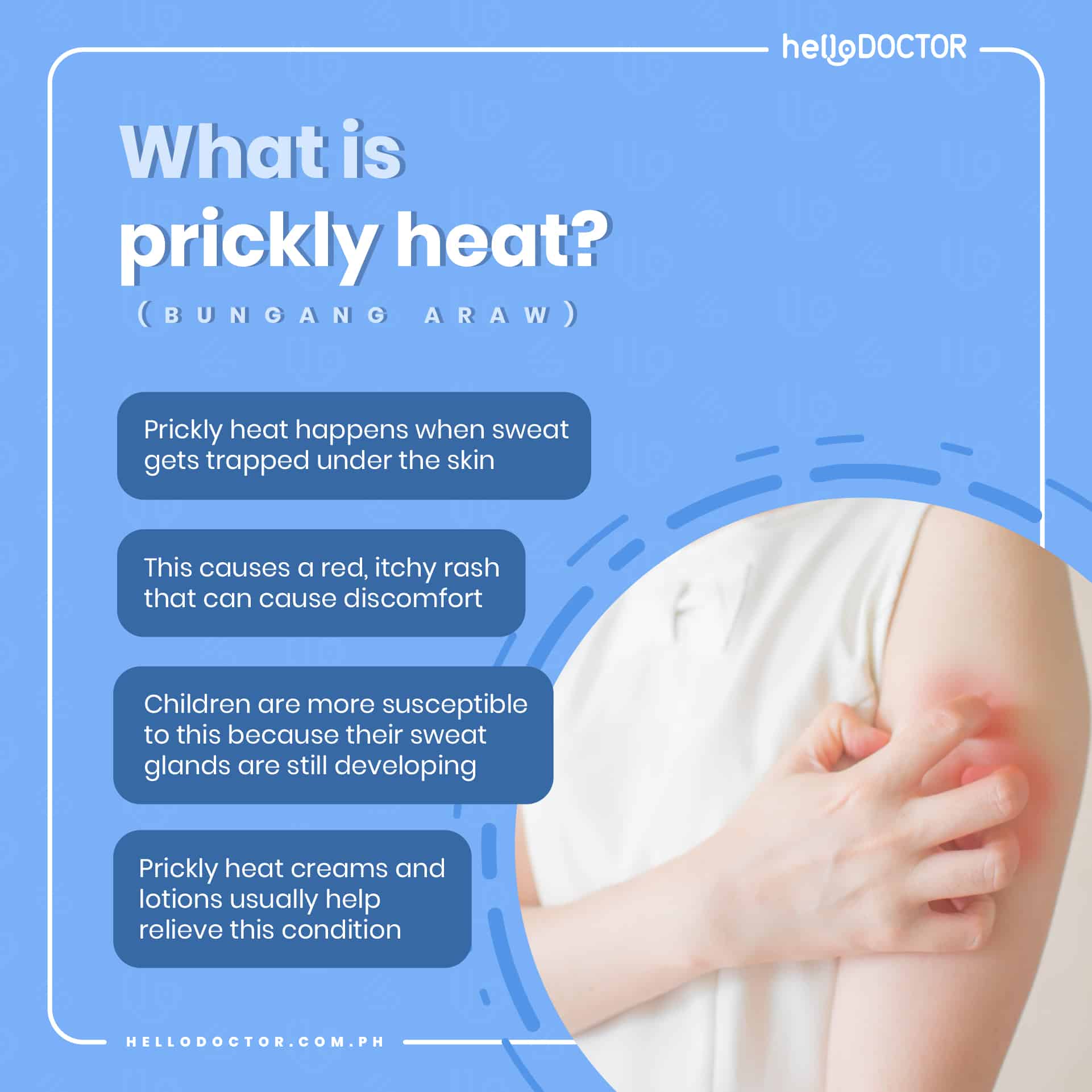How To Prevent Bungang Araw 4 Simple Ways To Avoid Prickly Heat Rash