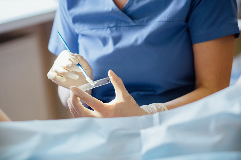 HPV Test vs Pap Smear What Should You Know About Them?