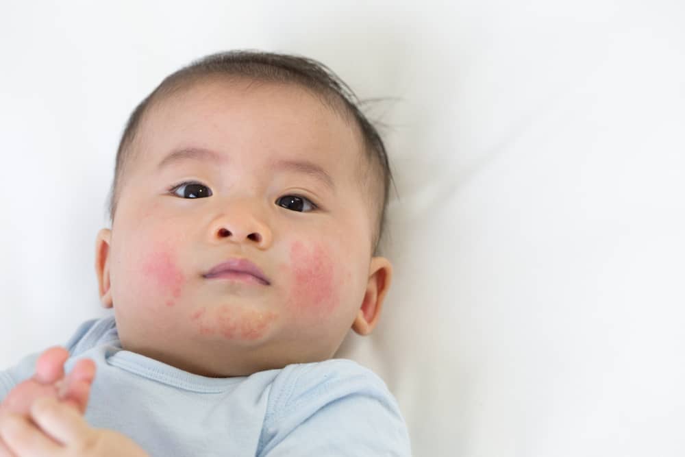 Petroleum Jelly for Baby Skin Benefits and Precautions
