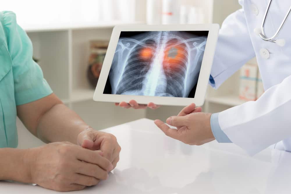 Lung Cancer Back Pain Can Be a Possible Symptom
